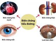 Các biến chứng của bệnh tiểu đường